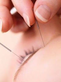 Fr acupuncture Brighton and Hove 727068 Image 1